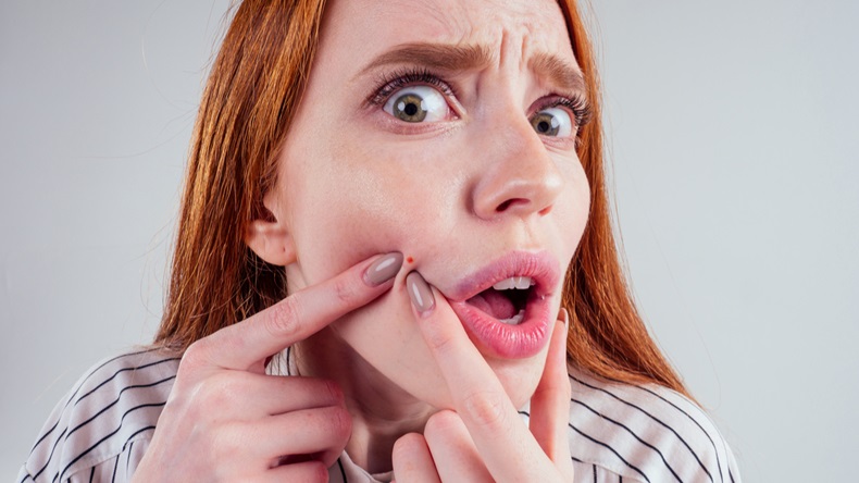 redhead student woman squeezing her pimples, removing pimple from her face white background studio - Image 